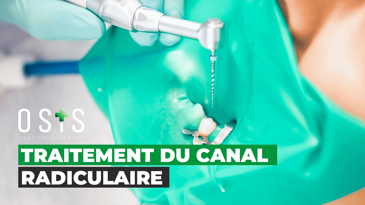 Traitement du Canal Radiculaire