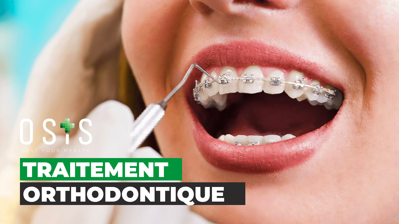 Traitement Orthodontique