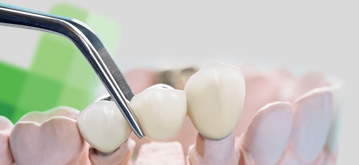 Prosthodontics Odontotherapy